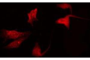 ABIN6272322 staining K562 by IF/ICC.