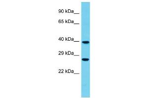 Host: Rabbit Target Name: FBXO44 Sample Type: Fetal Heart lysates Antibody Dilution: 1. (FBXO44 anticorps  (Middle Region))