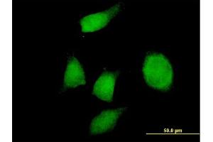 Immunofluorescence of purified MaxPab antibody to PHF17 on HeLa cell.