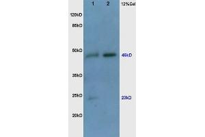 Human colon carcinoma lysates probed with Rabbit Anti-VEGF Polyclonal Antibody (ABIN727205) at 1:200 in 4 °C. (VEGF anticorps  (AA 27-120))
