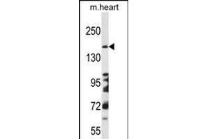 DCC Antibody (Center) (ABIN656268 and ABIN2845581) western blot analysis in mouse heart tissue lysates (35 μg/lane).