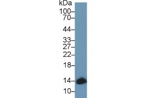 Detection of HBa1 in Mouse Cerebrum lysate using Polyclonal Antibody to Hemoglobin Alpha 1 (HBa1)