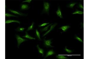 Immunofluorescence of monoclonal antibody to CRY2 on HeLa cell. (CRY2 anticorps  (AA 141-231))