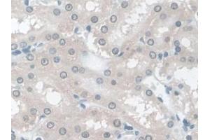 IHC-P analysis of Rat Kidney Tissue, with DAB staining. (TPSB2 anticorps  (AA 30-274))