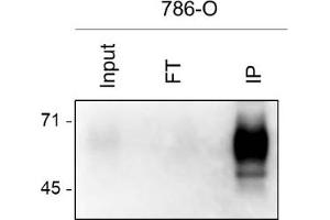786-O cell lysate was prepared by 1 mL of RIPA buffer from 1. (BST2 anticorps)