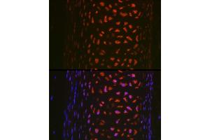 Immunofluorescence analysis of rat trachea using MMP13 Rabbit pAb (ABIN7268418) at dilution of 1:100 (40x lens). (MMP13 anticorps  (AA 262-471))