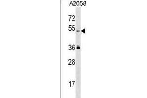 PREL Antibody (Center) (ABIN1537984 and ABIN2850411) western blot analysis in  cell line lysates (35 μg/lane). (PRAMEL anticorps  (AA 184-211))