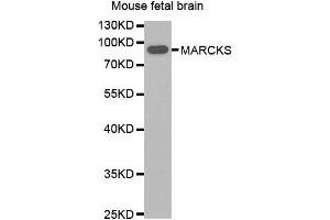 Western blot analysis of extracts of Mouse fetal brain, using MARCKS antibody. (MARCKS anticorps)