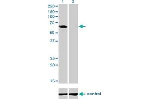 Western blot analysis of GGA1 over-expressed 293 cell line, cotransfected with GGA1 Validated Chimera RNAi (Lane 2) or non-transfected control (Lane 1). (GGA1 anticorps  (AA 1-89))