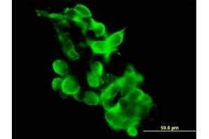 Immunofluorescence of purified MaxPab antibody to GPR34 on 293 cell. (GPR34 anticorps  (AA 1-381))