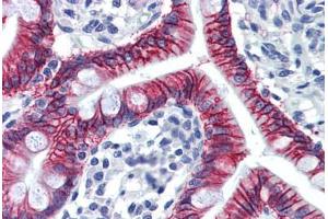 Human Small Intestine: Formalin-Fixed, Paraffin-Embedded (FFPE)