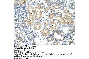 Rabbit Anti-RAVER1Antibody  Paraffin Embedded Tissue: Human Kidney Cellular Data: Epithelial cells of renal tubule Antibody Concentration: 4. (RAVER1 anticorps  (N-Term))