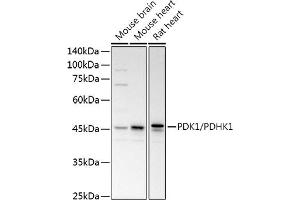 Western blot analysis of extracts of various cell lines, using PDK1/PDHK1 antibody (ABIN3015351, ABIN3015352, ABIN1681301, ABIN5663787 and ABIN6214001) at 1:1000 dilution. (PDPK1 anticorps  (AA 1-150))