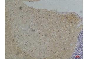 Immunohistochemistry (IHC) analysis of paraffin-embedded Mouse Brain Tissue using KV1. (Kv1.1 Potassium Channel anticorps)
