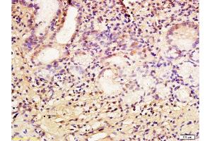 Formalin-fixed and paraffin embedded human gastric mucosa labeled with Anti-CA IX/CA9 Polyclonal Antibody, Unconjugated  at 1:200 followed by conjugation to the secondary antibody and DAB staining.