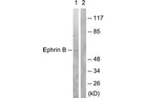 Western blot analysis of extracts from 293 cells, treated with EGF 200ng/ml 5', using EFNB1/2 (Ab-330) Antibody. (EFNB1/2 (AA 284-333) anticorps)
