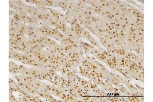 Immunoperoxidase of monoclonal antibody to PBX3 on formalin-fixed paraffin-embedded human adrenal gland.