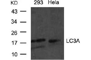 Image no. 1 for anti-Microtubule-Associated Protein 1 Light Chain 3 alpha (MAP1LC3A) (N-Term) antibody (ABIN319367) (MAP1LC3A anticorps  (N-Term))