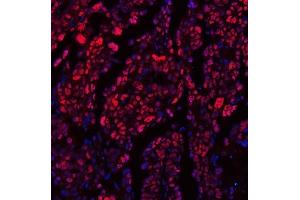 IF analysis of TRMT6 using anti-TRMT6 antibody (ABIN7602138). (TRMT6 anticorps  (AA 6-489))