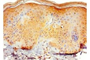 Immunohistochemistry of paraffin-embedded human skin tissue using ABIN7151129 at dilution of 1:100 (RNF125 anticorps  (AA 1-232))