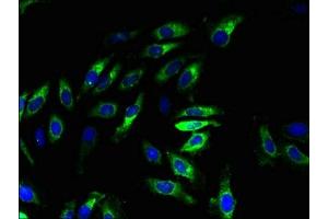 Immunofluorescent analysis of Hela cells using ABIN7175917 at dilution of 1:100 and Alexa Fluor 488-congugated AffiniPure Goat Anti-Rabbit IgG(H+L)