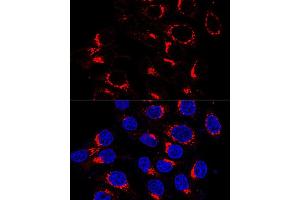 Immunofluorescence analysis of HeLa cells using USO1 antibody (ABIN7271235) at dilution of 1:200 (60x lens). (USO1 anticorps  (AA 663-962))
