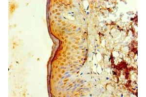 Immunohistochemistry of paraffin-embedded human skin tissue using ABIN7156730 at dilution of 1:100 (IL1A anticorps  (AA 1-152))