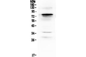 Western blot analysis of Complement C9 using anti-Complement C9 antibody .