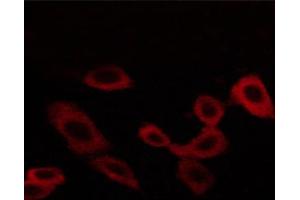 ABIN6267258 staining BT-20 cells by ICC/IF. (EGFR anticorps  (pThr678))