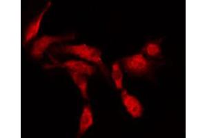 ABIN6266651 staining MDA-MB-435 by IF/ICC.