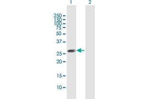 Western Blot analysis of CLTB expression in transfected 293T cell line by CLTB MaxPab polyclonal antibody. (CLTB anticorps  (AA 1-211))