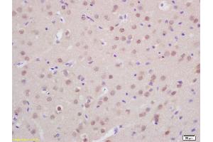 Formalin-fixed and paraffin embedded rat brain labeled with Anti-Prox1 Polyclonal Antibody, Unconjugated (ABIN680503) at 1:200 followed by conjugation to the secondary antibody and DAB staining