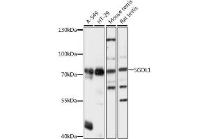 Western blot analysis of extracts of various cell lines, using SGOL1 antibody (ABIN7270288) at 1:1000 dilution. (Shugoshin anticorps  (AA 10-100))