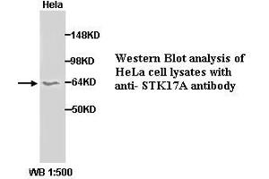 Image no. 1 for anti-serine/threonine Kinase 17a (STK17A) (C-Term) antibody (ABIN790926) (STK17A anticorps  (C-Term))