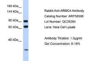 Western Blotting (WB) image for anti-Armadillo Repeat Containing 4 (ARMC4) (N-Term) antibody (ABIN2787749) (ARMC4 anticorps  (N-Term))