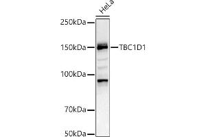 Western blot analysis of extracts of HeLa cells, using TBC1D1 antibody (ABIN6129487, ABIN6148878, ABIN6148879 and ABIN6225024) at 1:1000 dilution. (TBC1D1 anticorps  (AA 520-710))