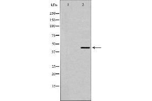 Western blot analysis of 5-HT-1A expression in HepG2 cells. (Serotonin Receptor 1A anticorps  (Internal Region))