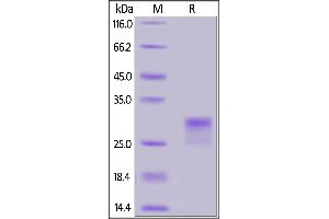 Biotinylated Human CD8 alpha, His,Avitag on  under reducing (R) condition.