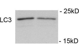 Immunoblots of SH-SY5Y cells treated with rapamycin for 1 h was probed with AP32191PU-N.