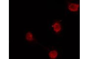 ABIN6274167 staining HuvEc cells by IF/ICC. (SKIL anticorps  (C-Term))