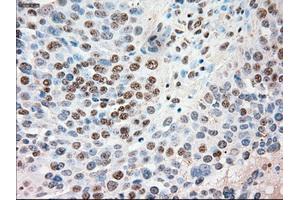 Immunohistochemical staining of paraffin-embedded Kidney tissue using anti-SIGLEC9mouse monoclonal antibody. (SIGLEC9 anticorps)