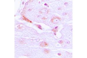 Immunohistochemical analysis of CABC1 staining in human brain formalin fixed paraffin embedded tissue section.