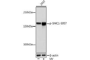 Western blot analysis of extracts of 293T cells, using Phospho-SMC1-S957 Rabbit mAb (ABIN7270613) at 1:1000 dilution. (SMC1A anticorps  (pSer957))