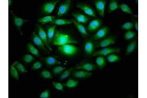 Immunofluorescence staining of A549 cells with ABIN7168493 at 1:266, counter-stained with DAPI.