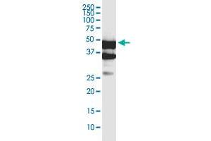 SERTAD4 monoclonal antibody (M02), clone 3G11. (SERTAD4 anticorps  (AA 1-356))