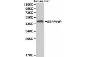 Western Blotting (WB) image for anti-serpin Peptidase Inhibitor, Clade F (Alpha-2 Antiplasmin, Pigment Epithelium Derived Factor), Member 1 (SERPINF1) antibody (ABIN1874740) (PEDF anticorps)