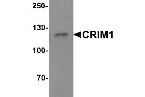 Western blot analysis of CRIM1 in Jurkat cell lysate with Crim1 antibody at 1 µg/mL. (CRIM1 anticorps  (C-Term))