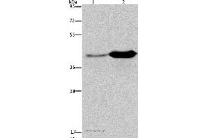 Western blot analysis of Mouse liver and brain tissue, using GLUL Polyclonal Antibody at dilution of 1:650 (GLUL anticorps)