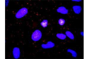 Proximity Ligation Analysis of protein-protein interactions between TGFA and ADAM17.