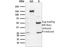 SDS-PAGE Analysis Purified p63 Mouse Monoclonal Antibody (TP63/1786). (p63 anticorps  (AA 3-106))